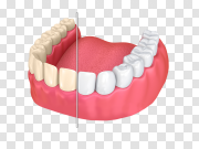 Dentures Transparent PNG 义齿透明PNG PNG图片